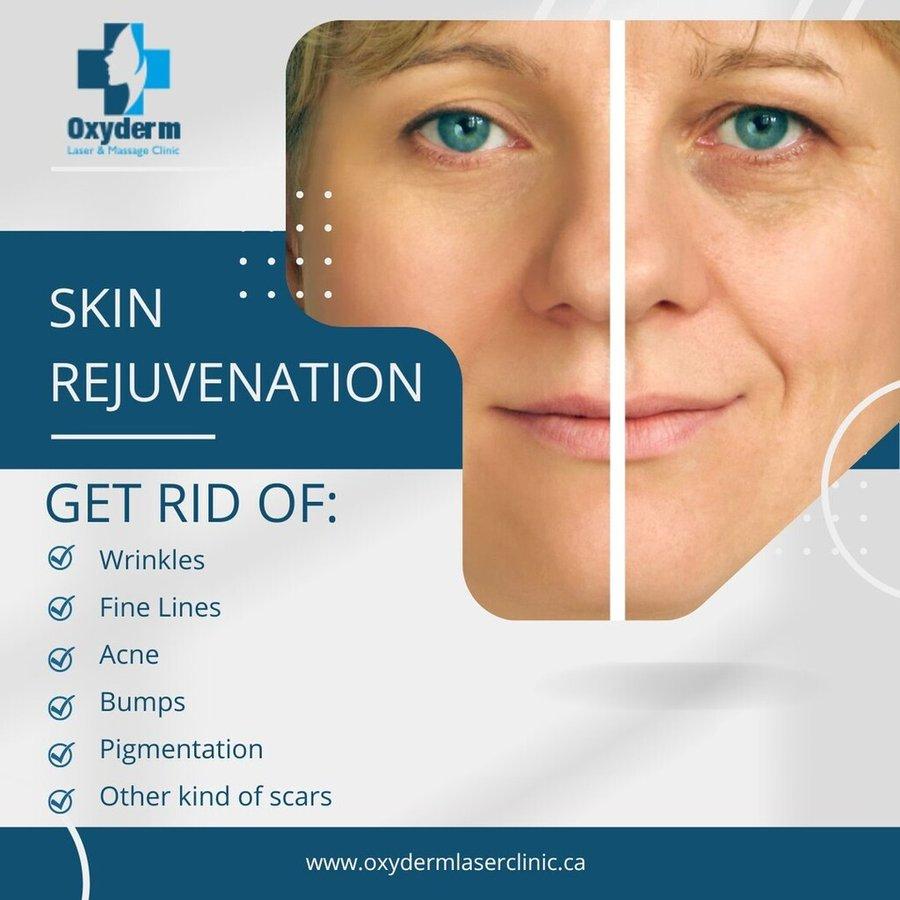 Laser facial hair removal Edmonton | Oxyderm laser clinic