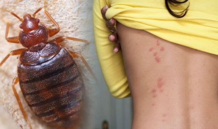 How to get rid of bed bugs: