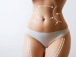 SmartLipo Laser Liposuction - Fast, Visible Results