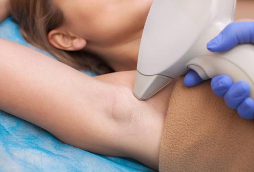 Best Tips For Laser Hair Removal